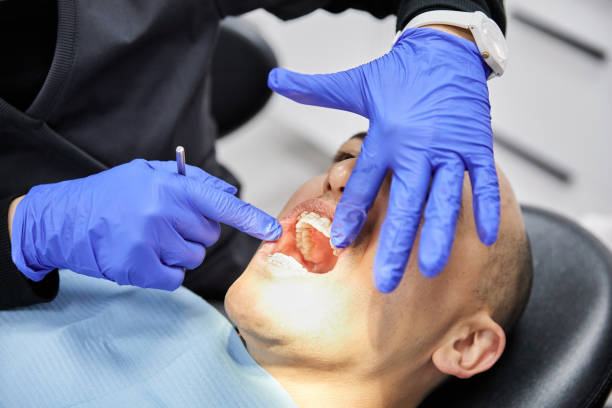 Best Emergency Tooth Extraction in Steelville, MO